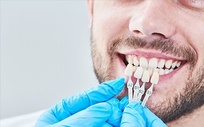 Dentist holding tooth color chart to a smiling patient