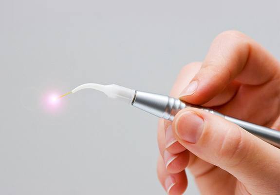 Hand holding soft tissue dental laser tool